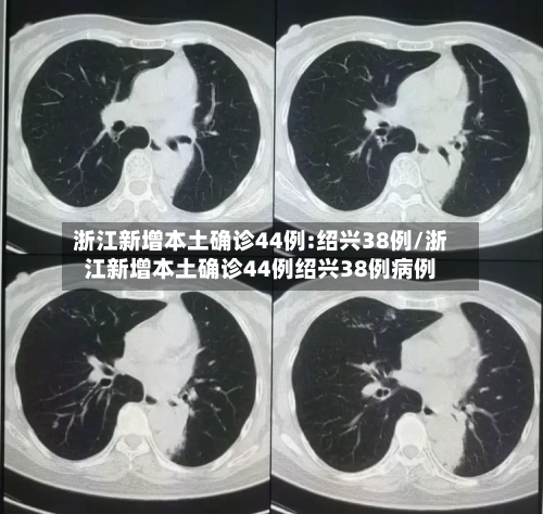 浙江新增本土确诊44例:绍兴38例/浙江新增本土确诊44例绍兴38例病例